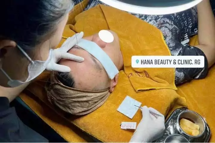 Hana Beauty & Clinic tại Kiên Giang, spa trị mụn Kiên Giang