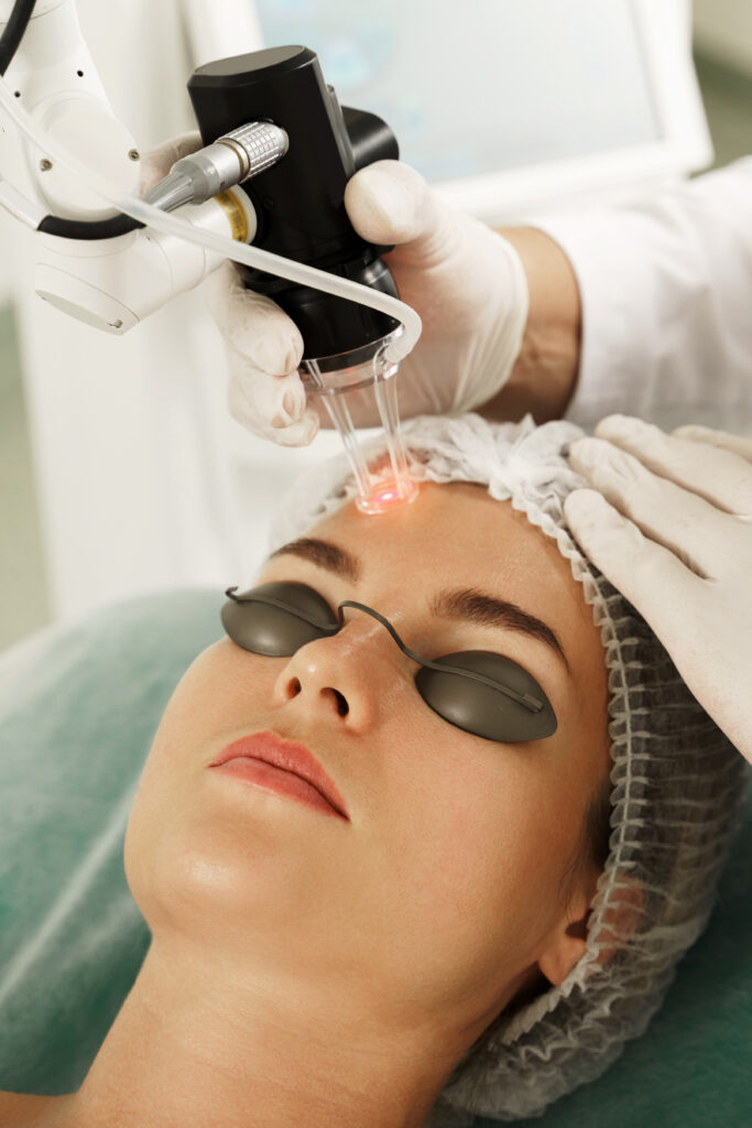 Không chỉ là spa trị nám Cần Thơ, Lona Skin Lab còn khẳng định chất lượng điều trị bằng laser tại địa chỉ trị nám tại Cần Thơ.