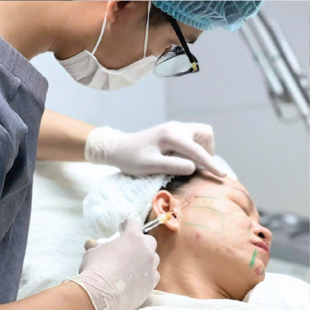 Hình ảnh minh họa quy trình làm đầy hóp má tại Cần Thơ, quy trình làm đầy hóp má được chuyên gia Lona thực hiện tại Cần Thơ bằng phương pháp tiêm filler và cấy mỡ tự thân, đảm bảo kết quả tự nhiên.