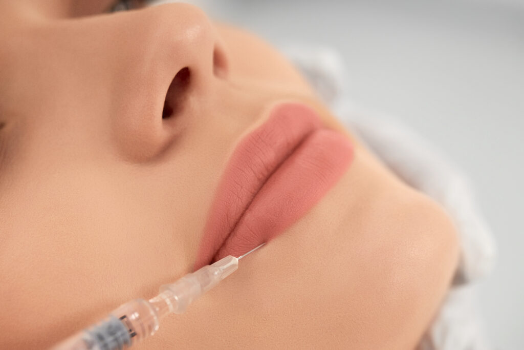 Quá trình làm đầy hóp má tại Cần Thơ được chuyên gia Lona tiến hành với tiêm filler và cấy mỡ tự thân, khẳng định làm đầy hóp má an toàn và hiệu quả cho mọi khách hàng tại Cần Thơ.