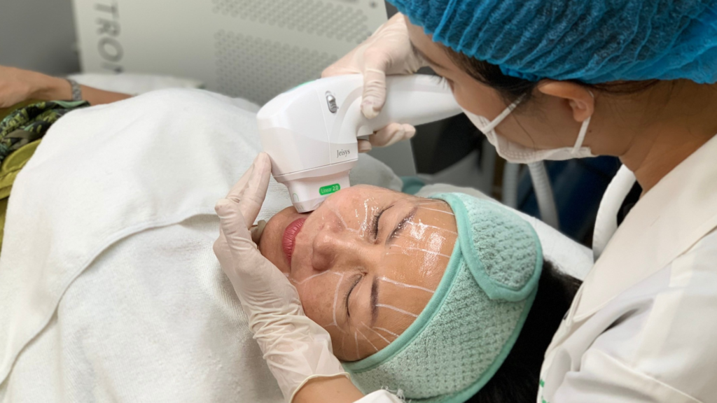Hình ảnh ghi lại khoảnh khắc HIFU nâng cơ tại Cần Thơ kết hợp cùng công nghệ Hifu tiên tiến, dưới sự giám sát của các bác sĩ giỏi nâng cơ tại Lona Skin Lab.