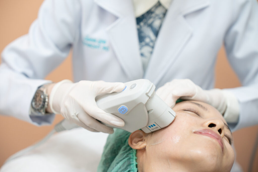 Với hình ảnh hifu12.jpg, Lona Skin Lab chứng minh cam kết cung cấp dịch vụ HIFU tại Cần Thơ xuất sắc qua quy trình nâng cơ HIFU tại Cần Thơ do đội ngũ bác sĩ giỏi nâng cơ HIFU thực hiện, góp phần trẻ hóa da HIFU Cần Thơ một cách hiệu quả.