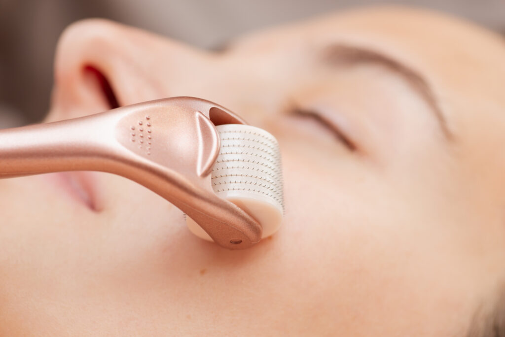 Lợi ích vượt trội của Ultherapy tại Cần Thơ và Ultherapy Cần Thơ, khi được thực hiện bởi bác sĩ giỏi Cần Thơ tại Lona Skin Lab, thể hiện qua quy trình nâng cơ không phẫu thuật mang lại trẻ hóa da Cần Thơ toàn diện.