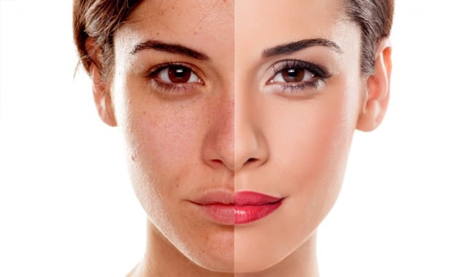 Hình ảnh này thể hiện sản phẩm chất lượng, hỗ trợ peel trị nám tại Cần Thơ, góp phần khẳng định tính hiệu quả của phương pháp trị nám trong việc tái tạo làn da rực rỡ.