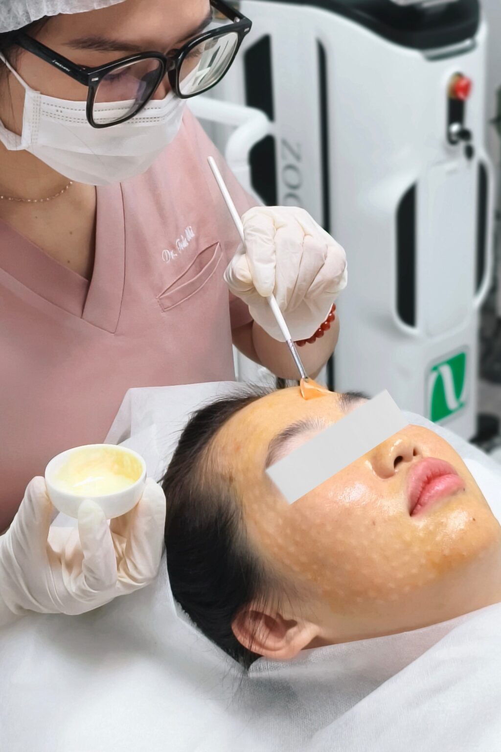 Ảnh chụp quy trình chuyên sâu cho thấy trị sạm da tại Cần Thơ, với trị sạm da Cần Thơ được triển khai bởi chuyên gia Lona qua liệu pháp điều trị nám da Cần Thơ tại các spa uy tín Cần Thơ, đồng thời mang đến trải nghiệm chăm sóc da chuyên sâu tối ưu.