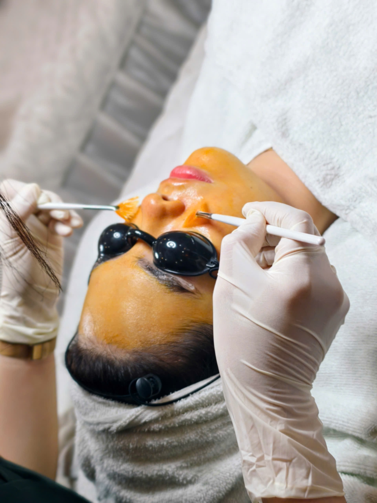Hình ảnh sau cùng thể hiện bước cuối cùng của peel da sinh học tại Cần Thơ, với Peel da sinh học tại Cần Thơ được thực hiện bởi các chuyên gia giàu kinh nghiệm; quy trình Peel da Cần Thơ kết hợp Thay da sinh học Cần Thơ hiện đại giúp cung cấp Dịch vụ peel da Cần Tho an toàn và tối ưu, đạt chuẩn Spa peel da Cần Tho chuyên sâu.