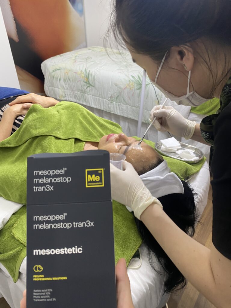 Qua ảnh này, chúng ta thấy rõ sự cải thiện của làn da qua peel da sinh học tại Cần Thơ được thực hiện theo chuẩn mực y tế; Peel da sinh học tại Cần Thơ cùng với công nghệ Peel da Cần Tho hiện đại hỗ trợ Thay da sinh học Cần Tho, tạo nên Dịch vụ peel da Cần Tho an toàn và hiệu quả, được cung cấp tại Spa peel da Cần Tho.