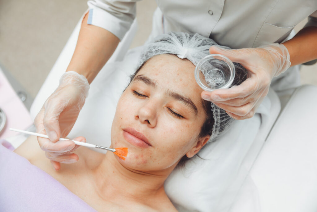Ảnh này minh họa quy trình peel da sinh học tại Cần Thơ tiên tiến, trong đó Peel da sinh học tại Cần Thơ được áp dụng cẩn thận để tối ưu hóa cấu trúc da; tiến trình Peel da Cần Thơ hỗ trợ Thay da sinh học Cần Thơ một cách hiệu quả, mang lại Dịch vụ peel da Cần Tho chất lượng cao tại Spa peel da Cần Tho.