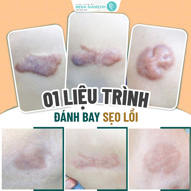 Viện Thẩm Mỹ Quốc Tế Maga GangJin Tiền Giang