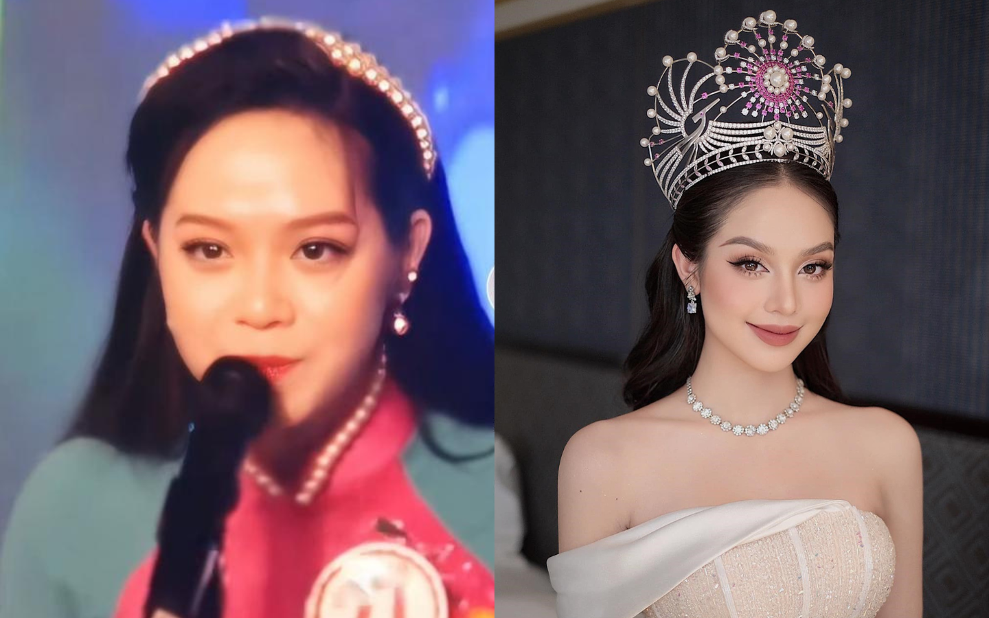 Ảnh phẫu thuật thẩm mỹ của hoa hậu Thanh Thuỷ gây sốt: Bác sĩ cảnh ...