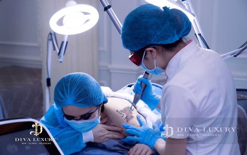DIVA LUXURY - phi kim trị sẹo Kiên Giang